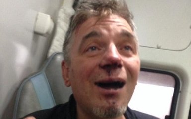 В России избили известного художника, соцсети кипят