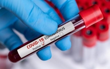 Количество больных коронавирусом в Украине растет стремительными темпами - официальные данные на 2 августа