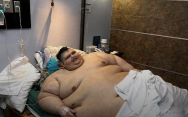 У Мексиці прооперували чоловіка вагою в майже 600 кілограм