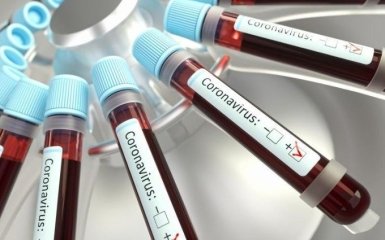 Кількість хворих на коронавірус в Україні стрімко збільшується - офіційні дані на 29 травня