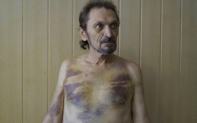 На расстрел выводили трижды: пастор из Донецка рассказал о пытках в ДНР