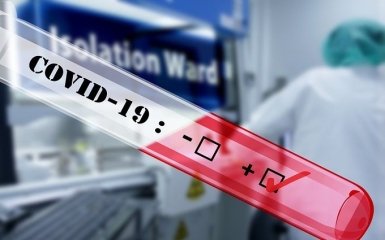 В США оцінили ймовірність витоку коронавірусу з лабораторії в Ухані
