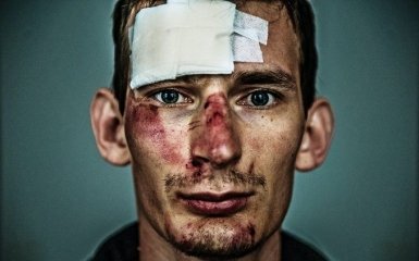 Стокгольмский синдром: почему некоторые украинцы оправдывают преступления россиян