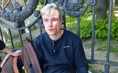 В Киеве избили участника ЛГБТ-марша: опубликованы фото