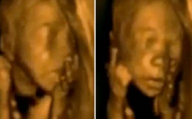 Новым хитом Facebook стало видео танца малыша в утробе матери