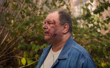 Ракетный удар РФ по Одессе — увеличилось количество погибших и пострадавших