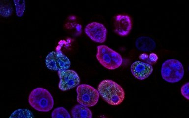 лечение рака