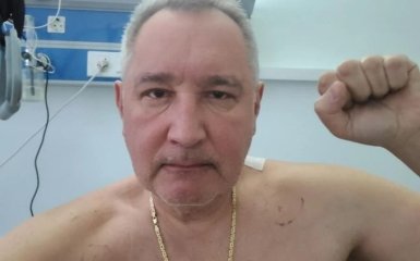 Рогозин отправил Макрону вытянутый из хребта осколок мины