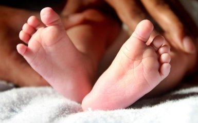 В Израиле родился уникальный ребенок с близнецом в желудке