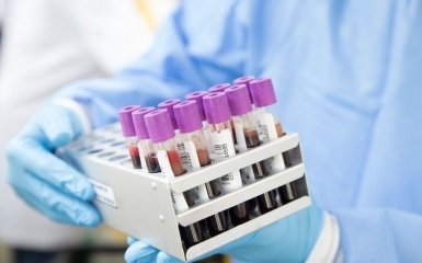 Кількість хворих на коронавірус в Україні зростає шаленими темпами - офіційні дані на 22 липня