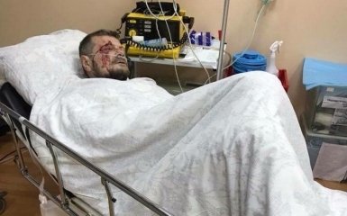 Покушение на Мосийчука в Киеве: врачи рассказали о состоянии нардепа