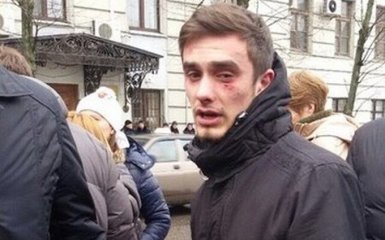 На мітингу проти Шокіна в Харкові розгорілася бійка: опубліковані фото