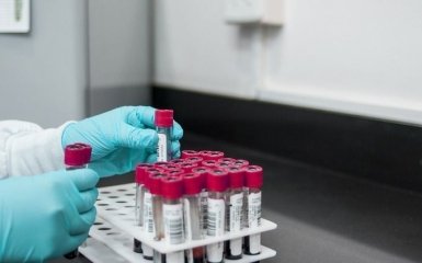 Науковці виявили нову небезпечну властивість коронавірусу