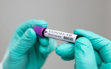 В Киеве возросло число больных коронавирусом - мэрия срочно обратилась к МВД