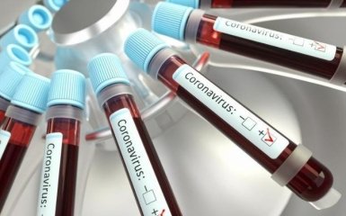 В МОЗ ответили, сколько стоит тестирование на коронавирус