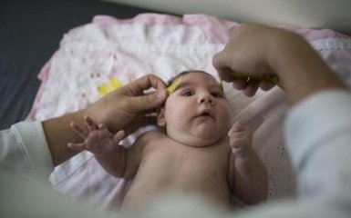 Более 3 тыс беременных заражены вирусом Зика в Колумбии