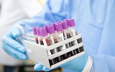 Кількість хворих на коронавірус в Україні різко зросла - офіційні дані на ранок 18 квітня