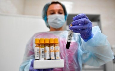 Количество больных коронавирусом в Украине наконец снижается - официальные данные на 22 июня