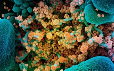 Науковці визначили частки геному, що пов'язані з ускладненнями від коронавірусу