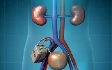 Американские ученые работают над созданием биоискусственной почки: опубликовано видео