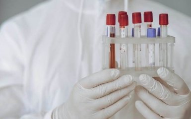 Кількість хворих коронавірусом в Україні знову стрімко зростає - офіційні дані на 22 травня