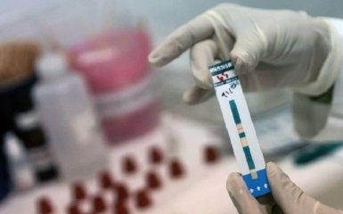 Військовим в зоні АТО запропонували безкоштовно перевіритися на ВІЛ-СНІД