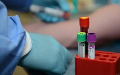 Кількість хворих на коронавірус в Україні продовжує знижуватися - офіційні дані на 13 липня