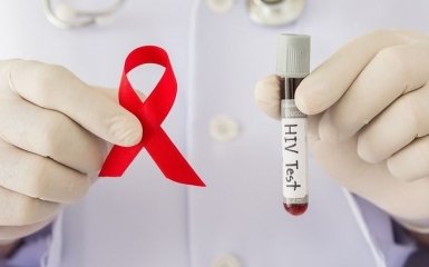 В Нидерландах обнаружили новую опасную форму ВИЧ-инфекции