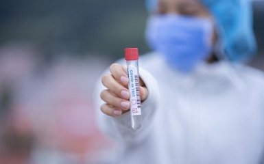 Количество больных коронавирусом в Украине рекордно возросло - официальные данные на 30 июля