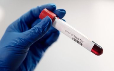 В США разработали инновационный тест на коронавирус - что о нем известно