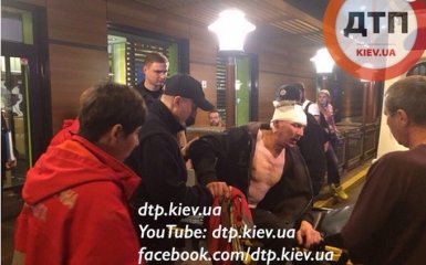 В Киеве разыгралась драматическая история с похищением и стрельбой: появились фото