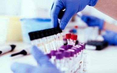 Чи варто робити тести на антитіла до коронавірусу — чітка відповідь вчених