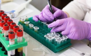 В Житомире подтвердили первый случай заболевания коронавирусом - важные данные