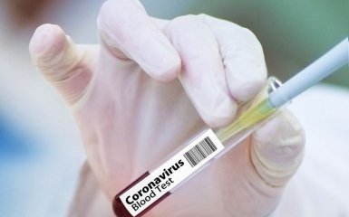 В Украине зафиксированы новые случаи заражения коронавирусом - что известно