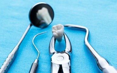 У Росії стоматолог видалила жінці 22 здорових зуба, щоб заробити мільйон рублів