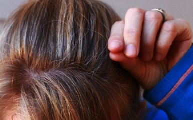 Ученые установили связь между стрессом и возникновением седины