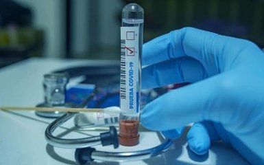 Количество больных коронавирусом в Украине растет очень быстро - официальные данные на 29 июля