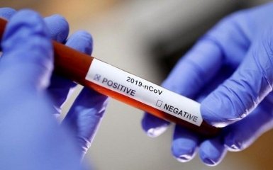 Количество больных коронавирусом в Украине резко выросло - официальные данные на 28 июля