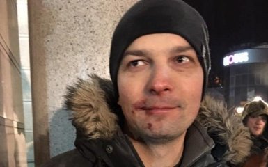 Убили депутата, а він задоволений: в мережі висміяли фото після сутичок в Києві