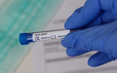 Количество больных коронавирусом в Украине стремительно растет - официальные данные на 15 августа