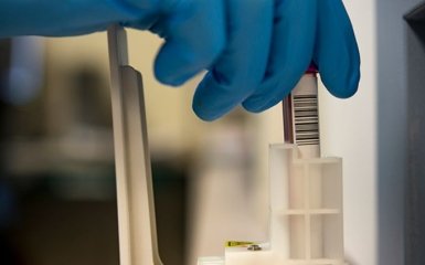 Може бути хибно - Степанов вразив новою заявою щодо епідемії COVID-19