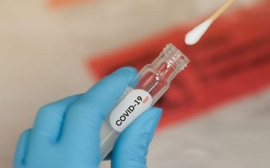 Кількість хворих на коронавірус в Україні рекордно зросла - офіційні дані на 13 серпня