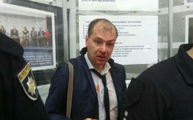 Націоналісти побили заступника голови партії "Розумна сила", - ЗМІ