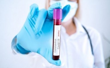 Кількість хворих на коронавірус в Україні стрімко зростає - офіційні дані на 20 липня