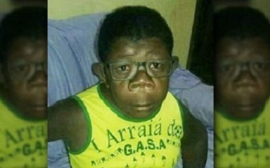 В Анголе исследуют мальчика, который "родился от женщины и шимпанзе"