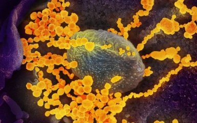 В МОЗ объяснили, что может вызвать осложнения во время болезни COVID-19