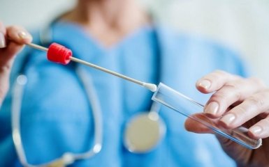 Кількість хворих на коронавірус в Україні зростає шаленими темпами - офіційні дані на 10 серпня