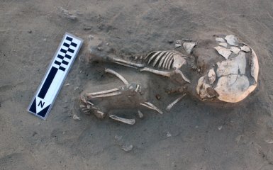 У останків немовляти діагностували цингу