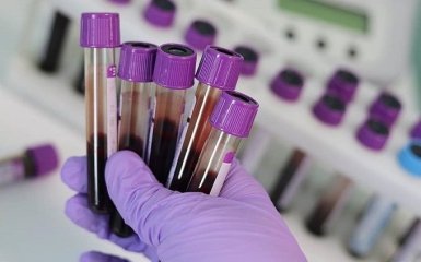 Ученые нашли эффективный метод лечения рака крови - сенсационная информация