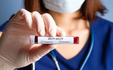 Тести не точні - вчені приголомшили світ шокуючими висновками щодо коронавірусу